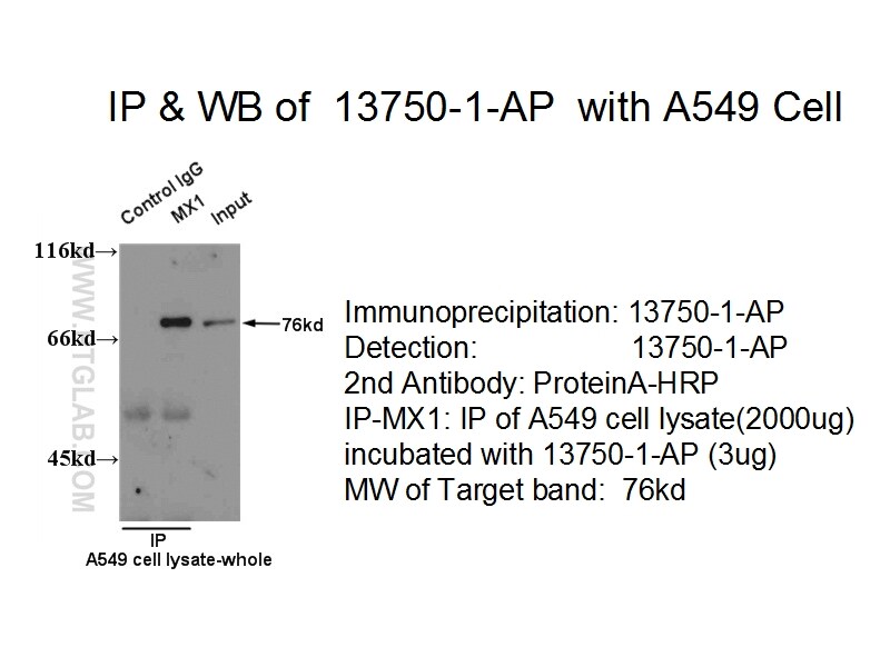 MX1 Antibody in Immunoprecipitation (IP)