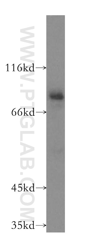 Spartin/SPG20 Antibody in Western Blot (WB)