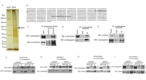gamma Catenin Antibody in Western Blot, Immunoprecipitation (WB, IP)