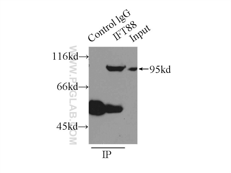 IFT88 Antibody in Immunoprecipitation (IP)