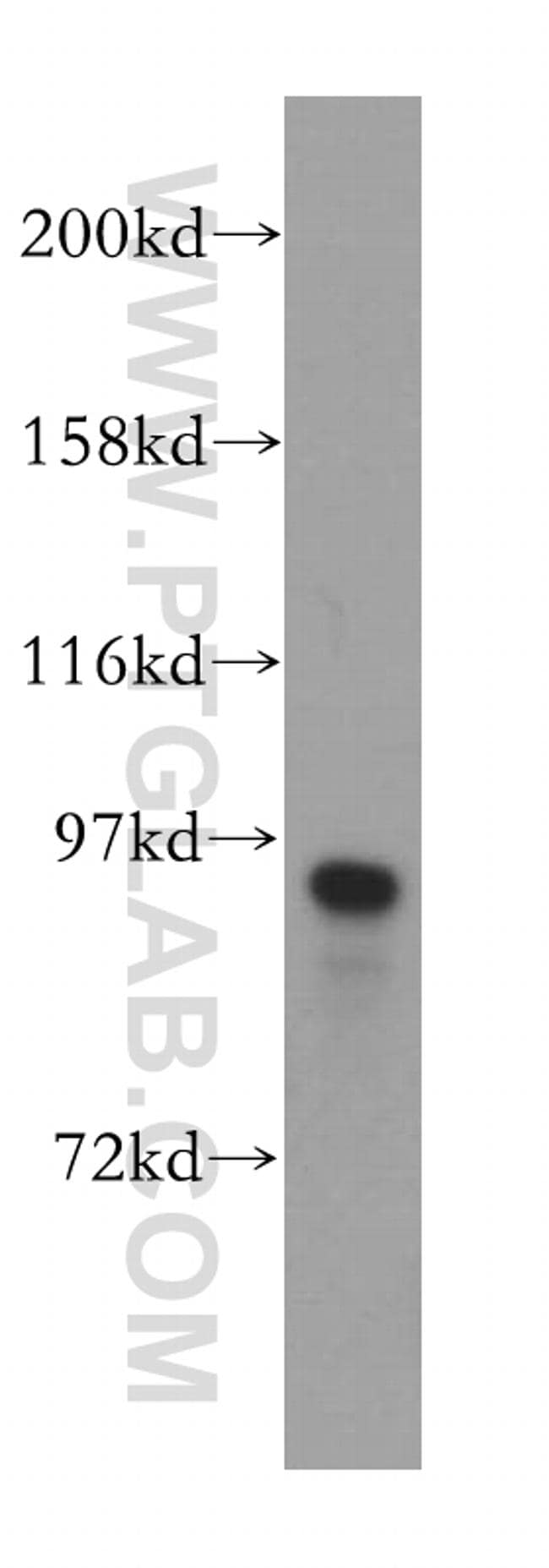 IFT88 Antibody in Western Blot (WB)