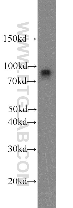 IFT88 Antibody in Western Blot (WB)
