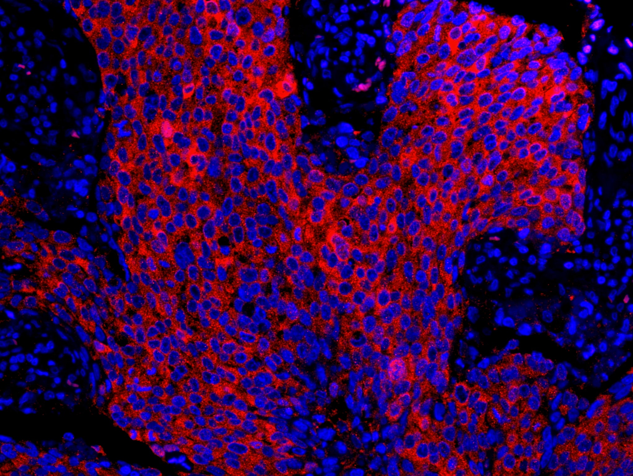 14-3-3 Sigma Antibody (IHC-00346)