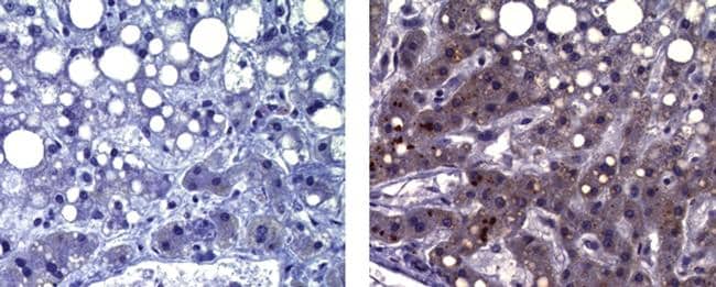 Mouse IgG1 kappa Isotype Control in Immunohistochemistry (Paraffin) (IHC (P))