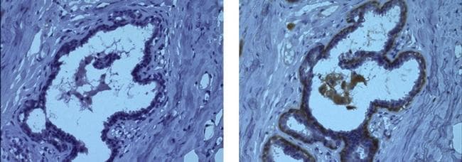 Mouse IgG1 kappa Isotype Control in Immunohistochemistry (Paraffin) (IHC (P))