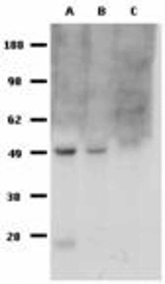 FOXP3 Antibody in Western Blot (WB)