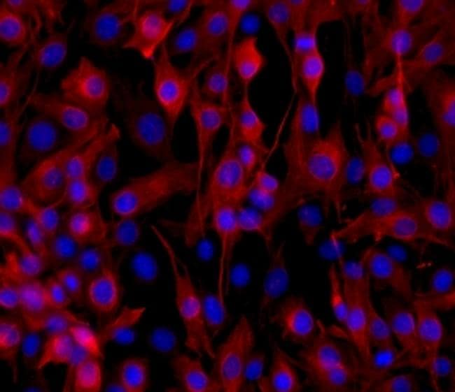 Desmin Antibody (14-9747-82)