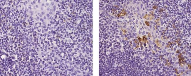 LAMP5 (BAD-LAMP) Antibody (14-9778-80)