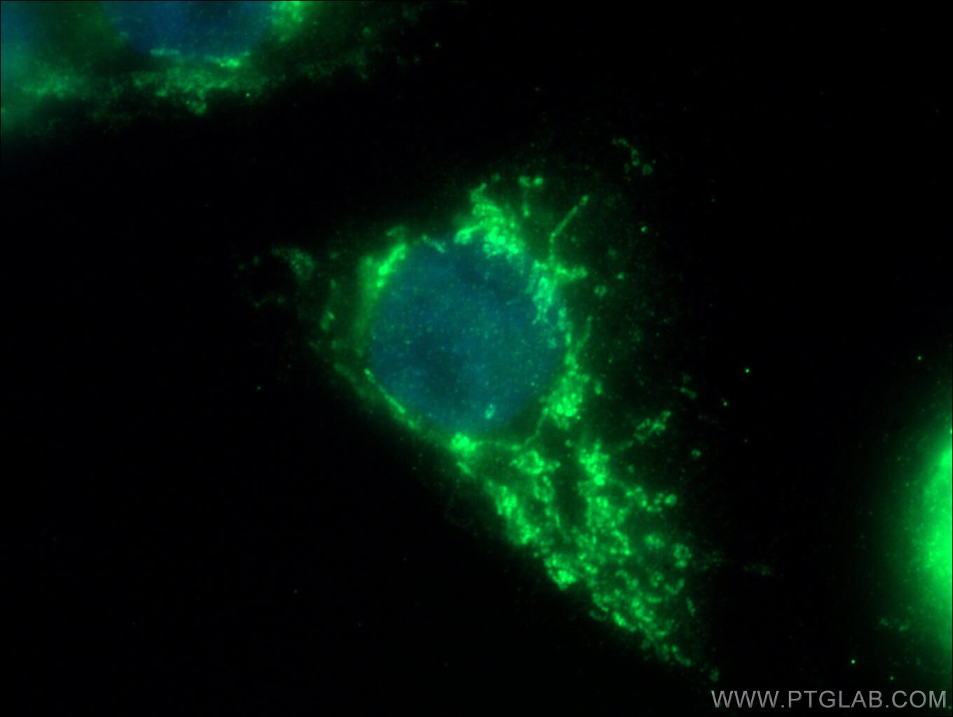 PARK2/Parkin Antibody (14060-1-AP)