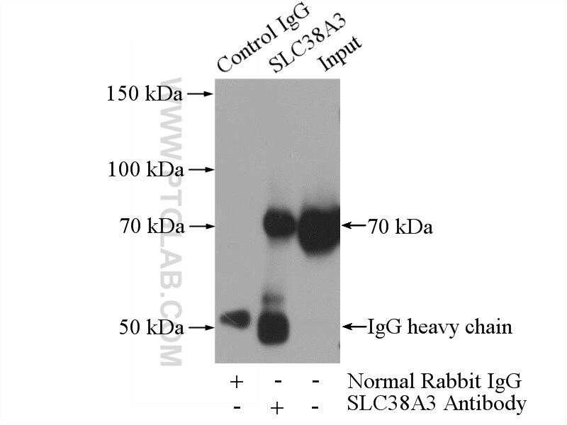 SLC38A3 Antibody in Immunoprecipitation (IP)