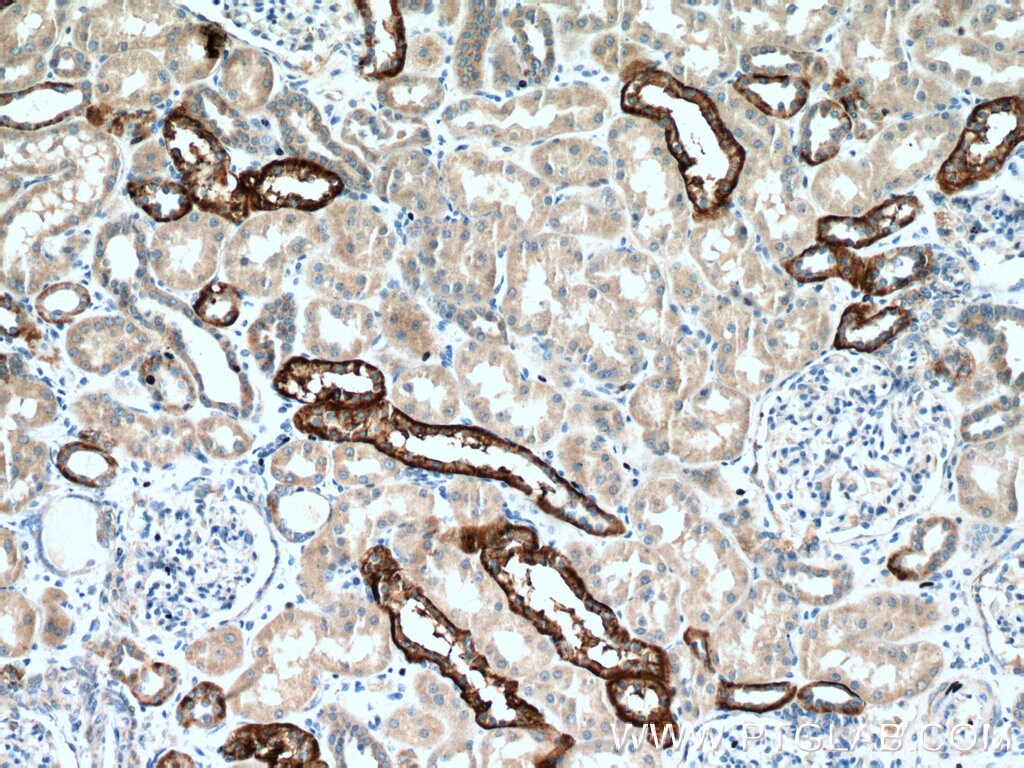 NOX4 Antibody (14347-1-AP)