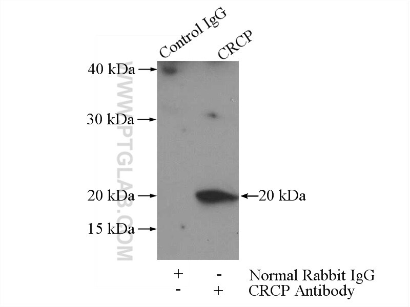 CRCP Antibody in Immunoprecipitation (IP)
