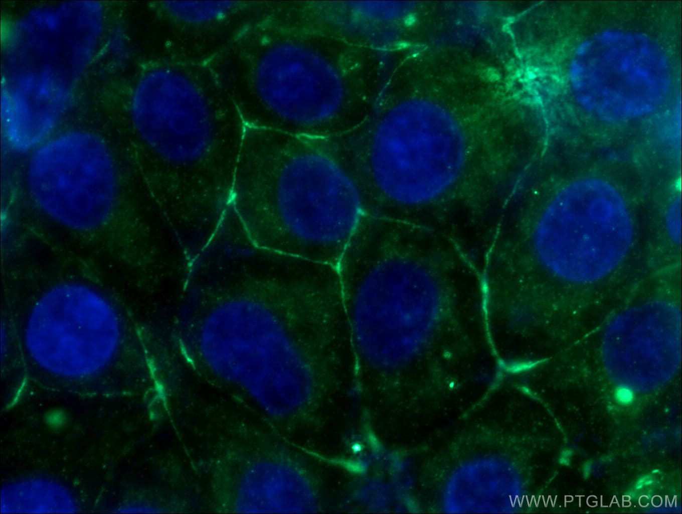 PKC Gamma Antibody (14364-1-AP)