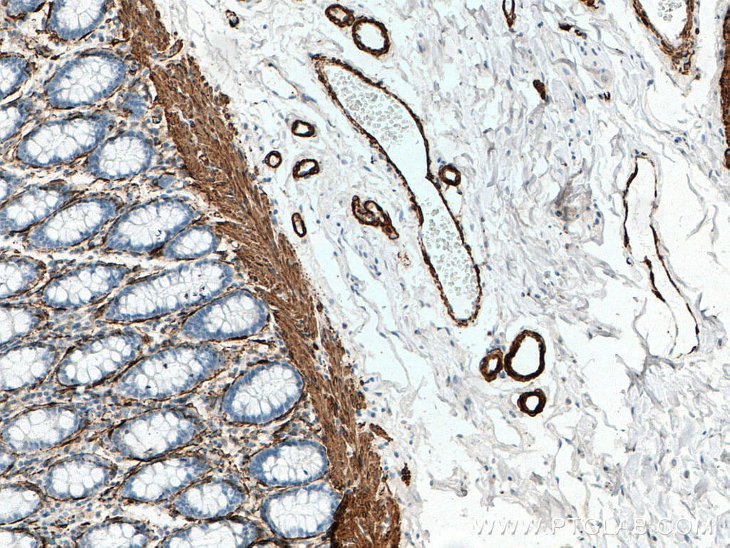 Acta2 Smooth Muscle Actin Antibody (14395-1-ap)