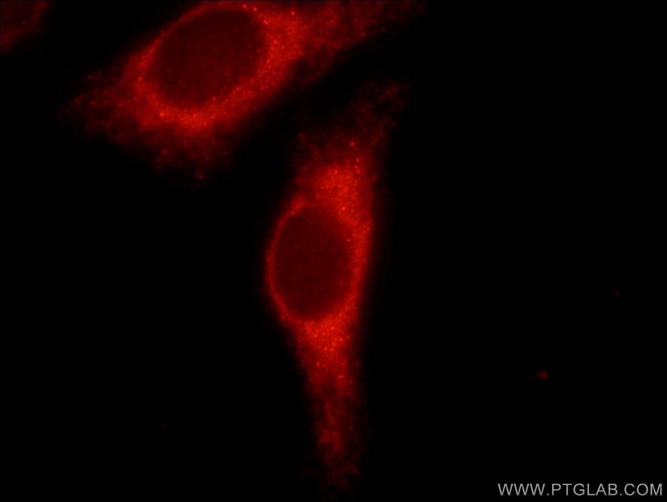 PPP1R15B Antibody in Immunocytochemistry (ICC/IF)