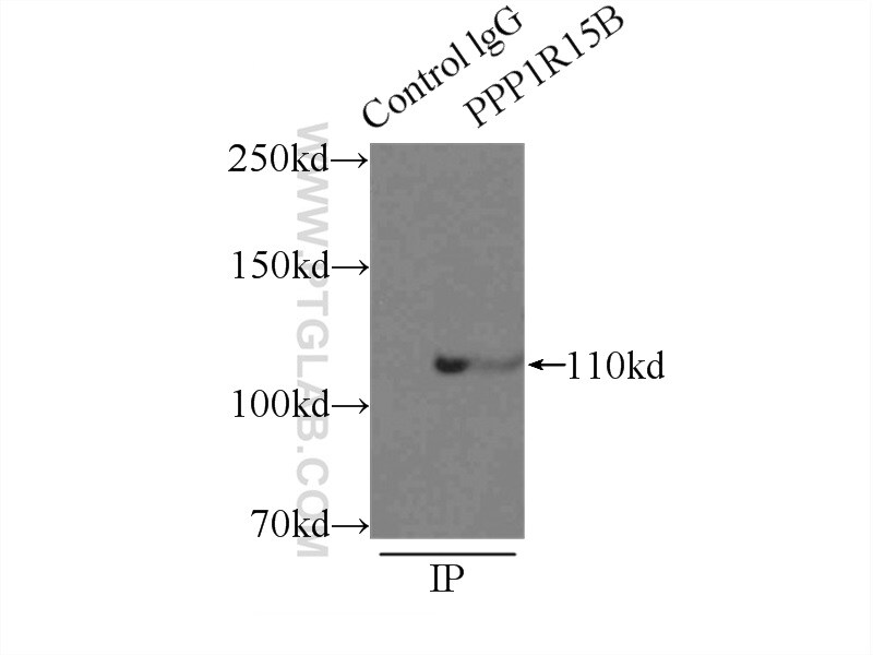 PPP1R15B Antibody in Immunoprecipitation (IP)