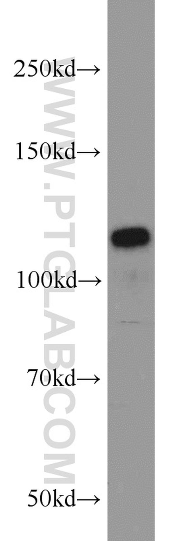 PPP1R15B Antibody in Western Blot (WB)