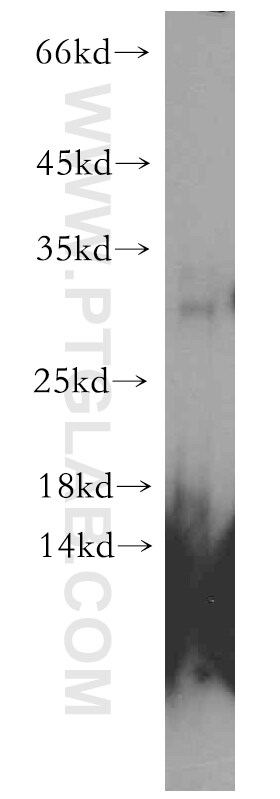 CHMP1B Antibody in Western Blot (WB)