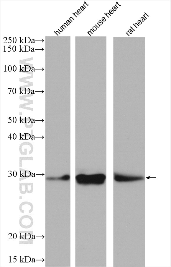 CHMP1B Antibody in Western Blot (WB)