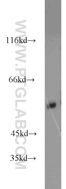 GPR37/Pael-R Antibody in Western Blot (WB)