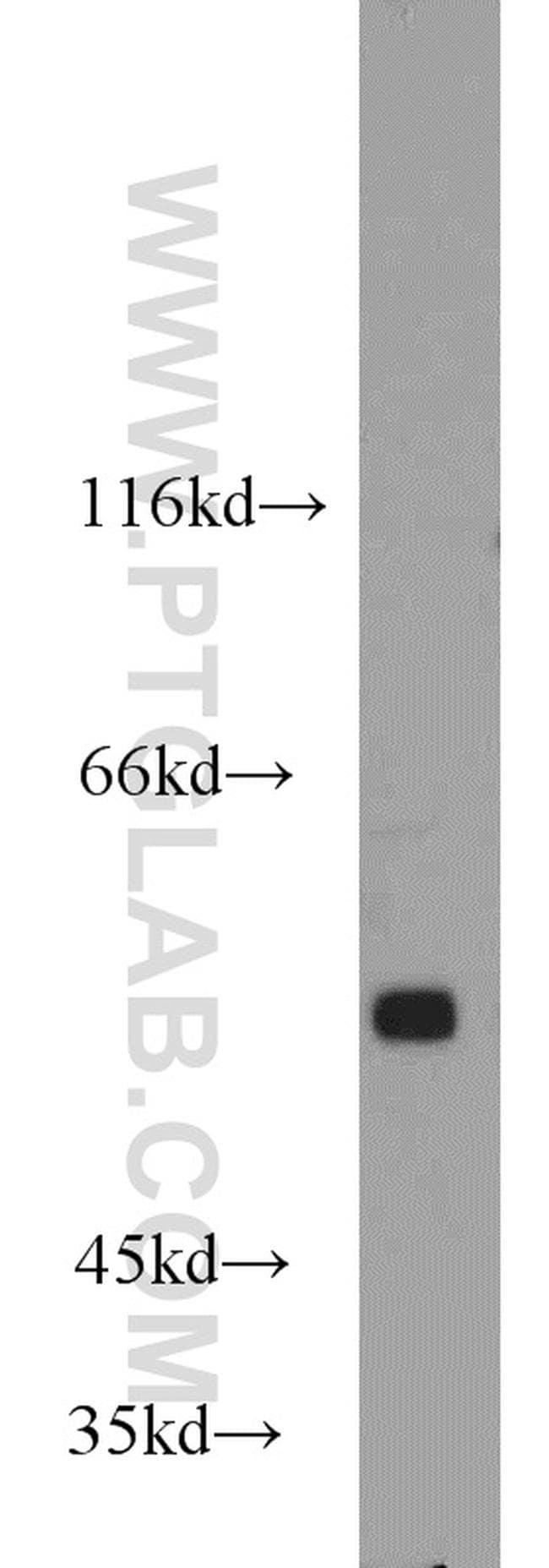 GPR37/Pael-R Antibody in Western Blot (WB)