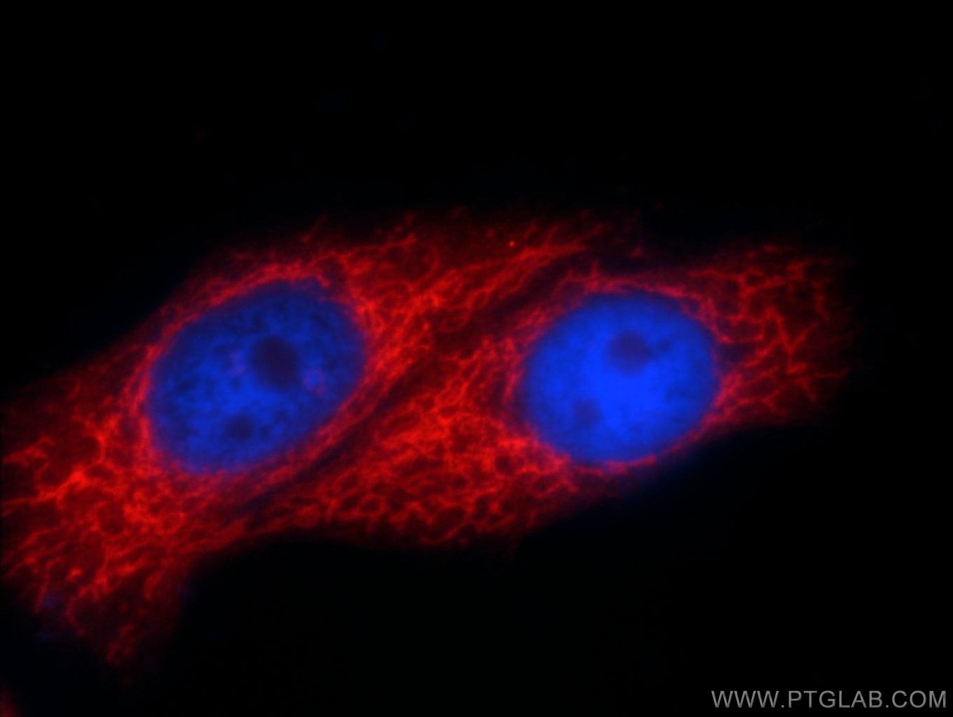 SLC25A6 Antibody (14841-1-AP)