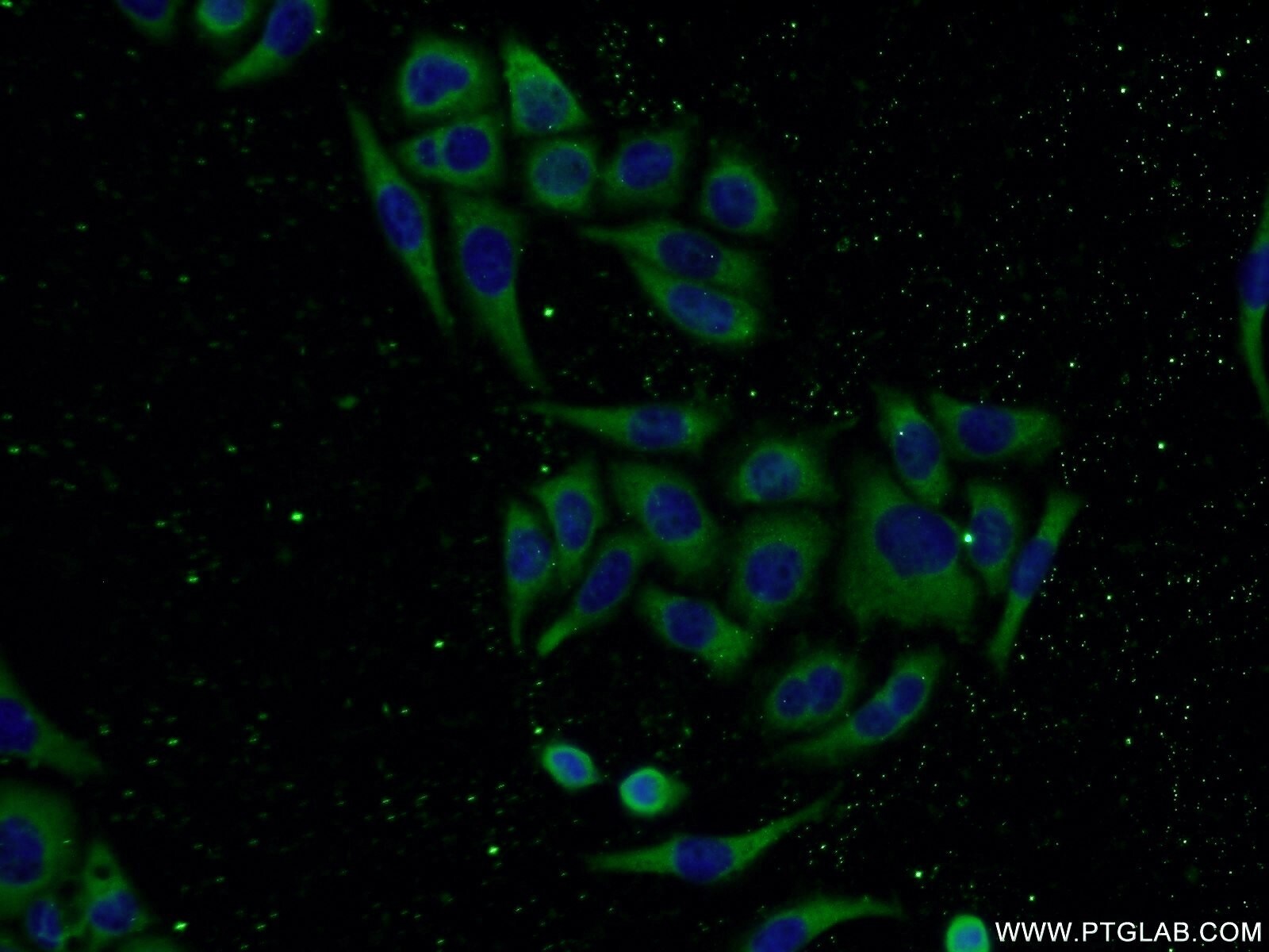 CNDP2 Antibody in Immunocytochemistry (ICC/IF)