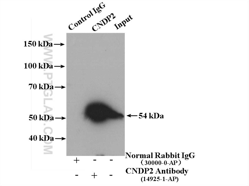 CNDP2 Antibody in Immunoprecipitation (IP)