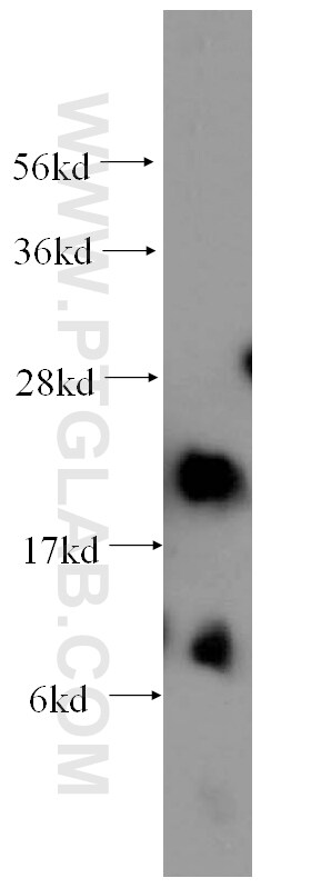 AK1 Antibody in Western Blot (WB)