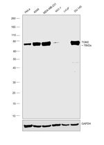 Tgm2 Antibody Pa5 29356