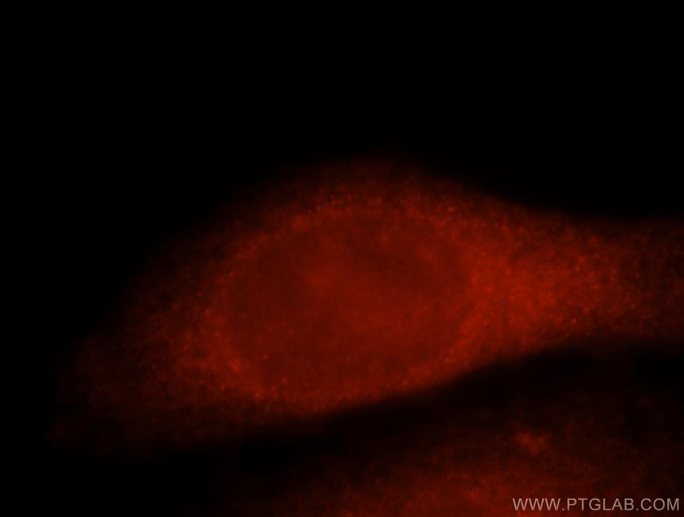 Thymidylate synthase Antibody (15047-1-AP)