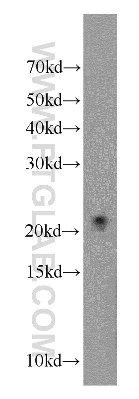 COQ7 Antibody in Western Blot (WB)