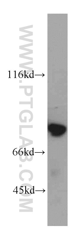 LMOD1 Antibody in Western Blot (WB)