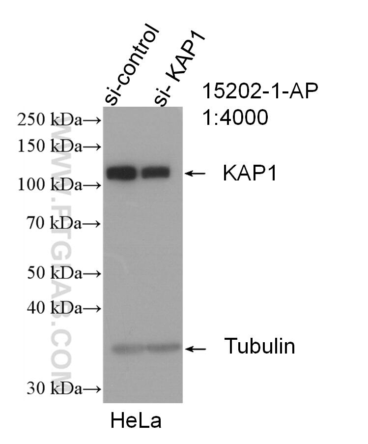 KAP1 Antibody in Western Blot (WB)