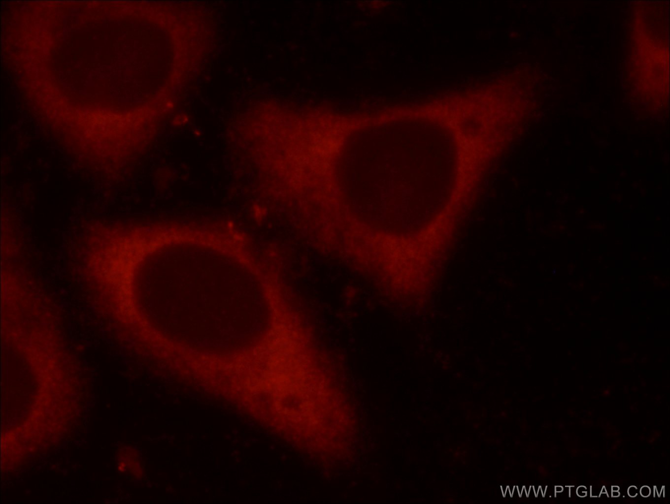 EIF4G1 Antibody in Immunocytochemistry (ICC/IF)