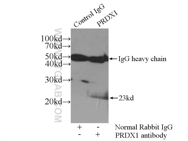 PRDX1 Antibody in Immunoprecipitation (IP)