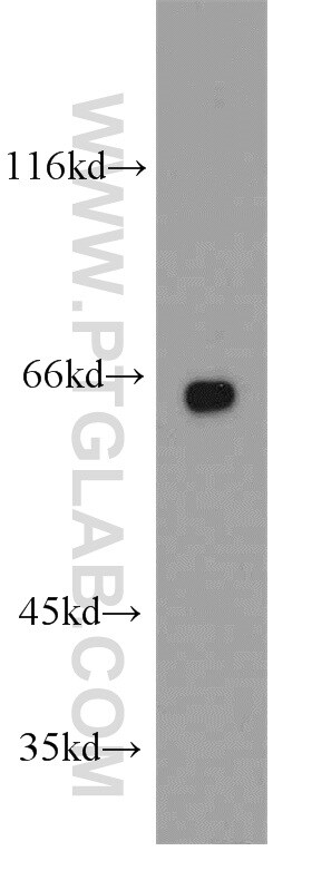 PPP2R1A Antibody in Western Blot (WB)
