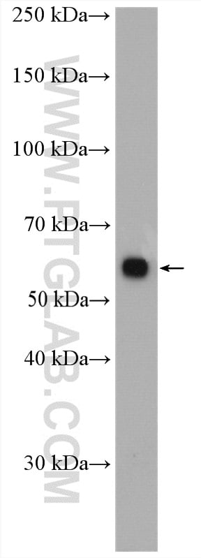 PPP2R1A Antibody in Western Blot (WB)