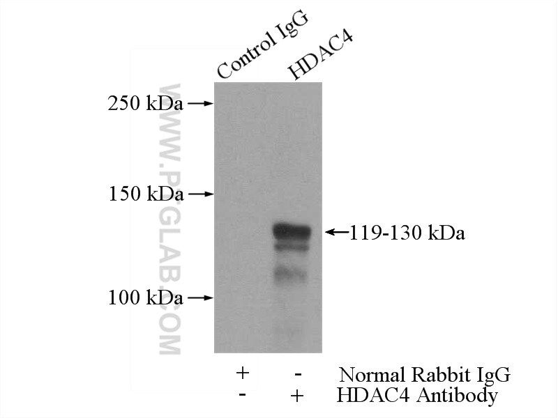 HDAC4 Antibody in Immunoprecipitation (IP)
