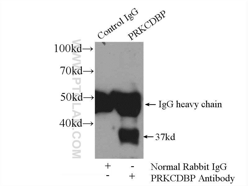 PRKCDBP Antibody in Immunoprecipitation (IP)