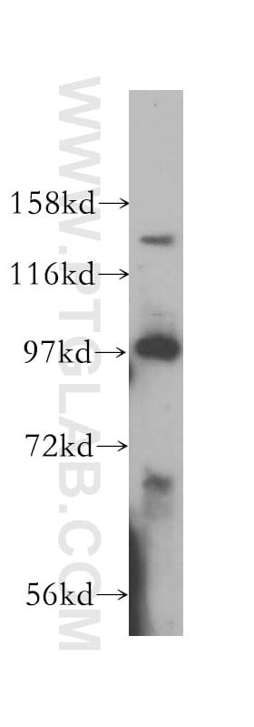 PAN2 Antibody in Western Blot (WB)