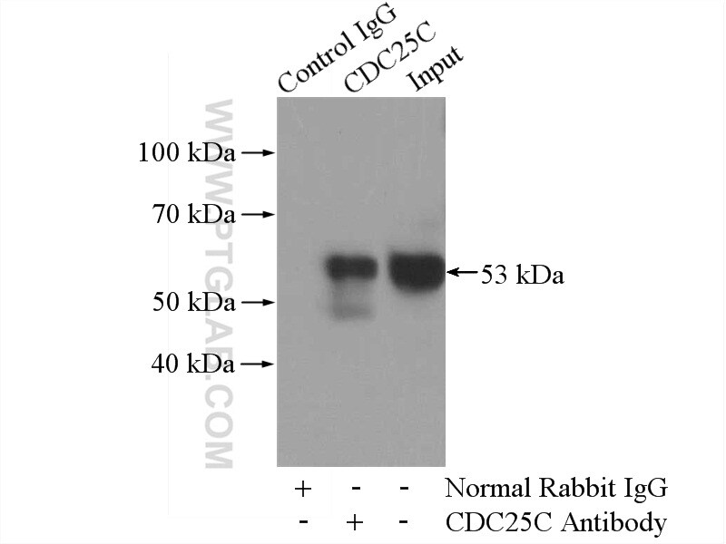 CDC25C Antibody in Immunoprecipitation (IP)