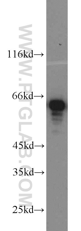 CKAP4 Antibody in Western Blot (WB)
