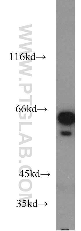 CKAP4 Antibody in Western Blot (WB)