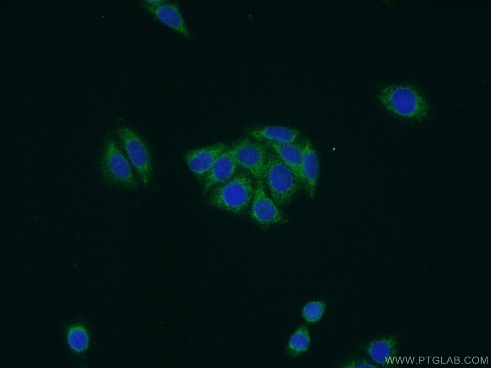 NDUFB11 Antibody in Immunocytochemistry (ICC/IF)