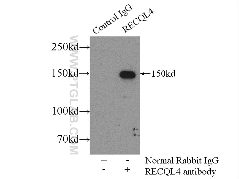 RECQL4 Antibody in Immunoprecipitation (IP)