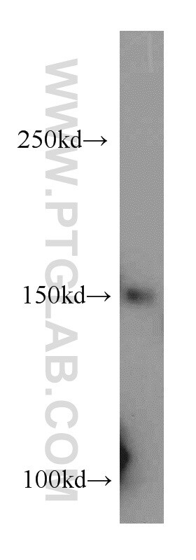 RECQL4 Antibody in Western Blot (WB)