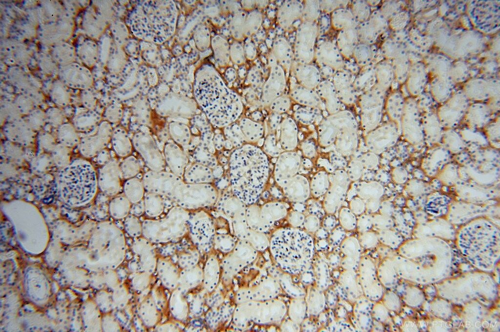 Collagen Type VI Antibody in Immunohistochemistry (Paraffin) (IHC (P))