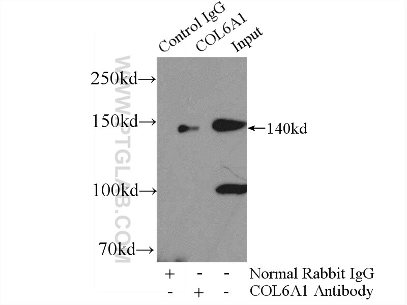 Collagen Type VI Antibody in Immunoprecipitation (IP)