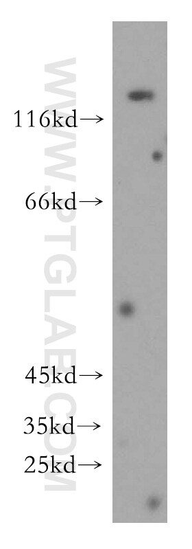 Collagen Type VI Antibody in Western Blot (WB)